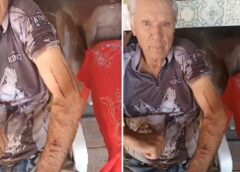Vídeo mostra ex-morador de Assis Chateaubriand com ferimentos após suposto ataque de onça em Toledo