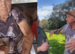 Vídeo: Ex morador de Assis Chateaubriand atacado pela onça relata que lutou contra o felino para sobreviver”Era ela ou eu.”